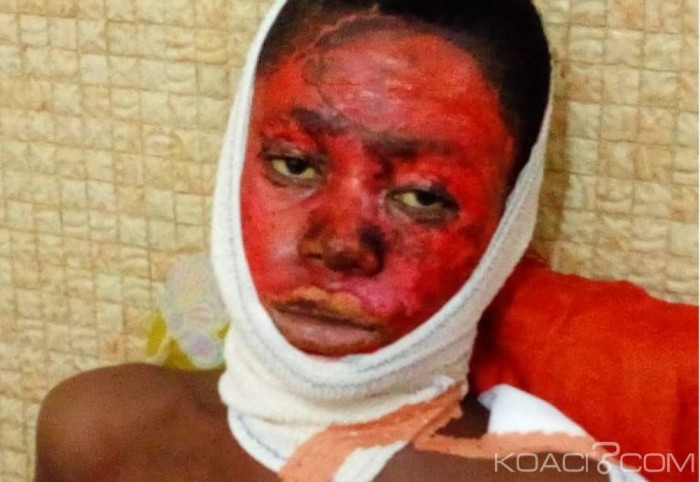 Côte d'Ivoire : Une victime des événements de Béoumi abandonnée à son propre sort