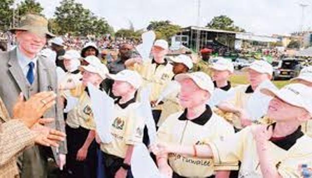 Sénégal: les albinos reprochent aux autorités la non prise en charge leurs préoccupations