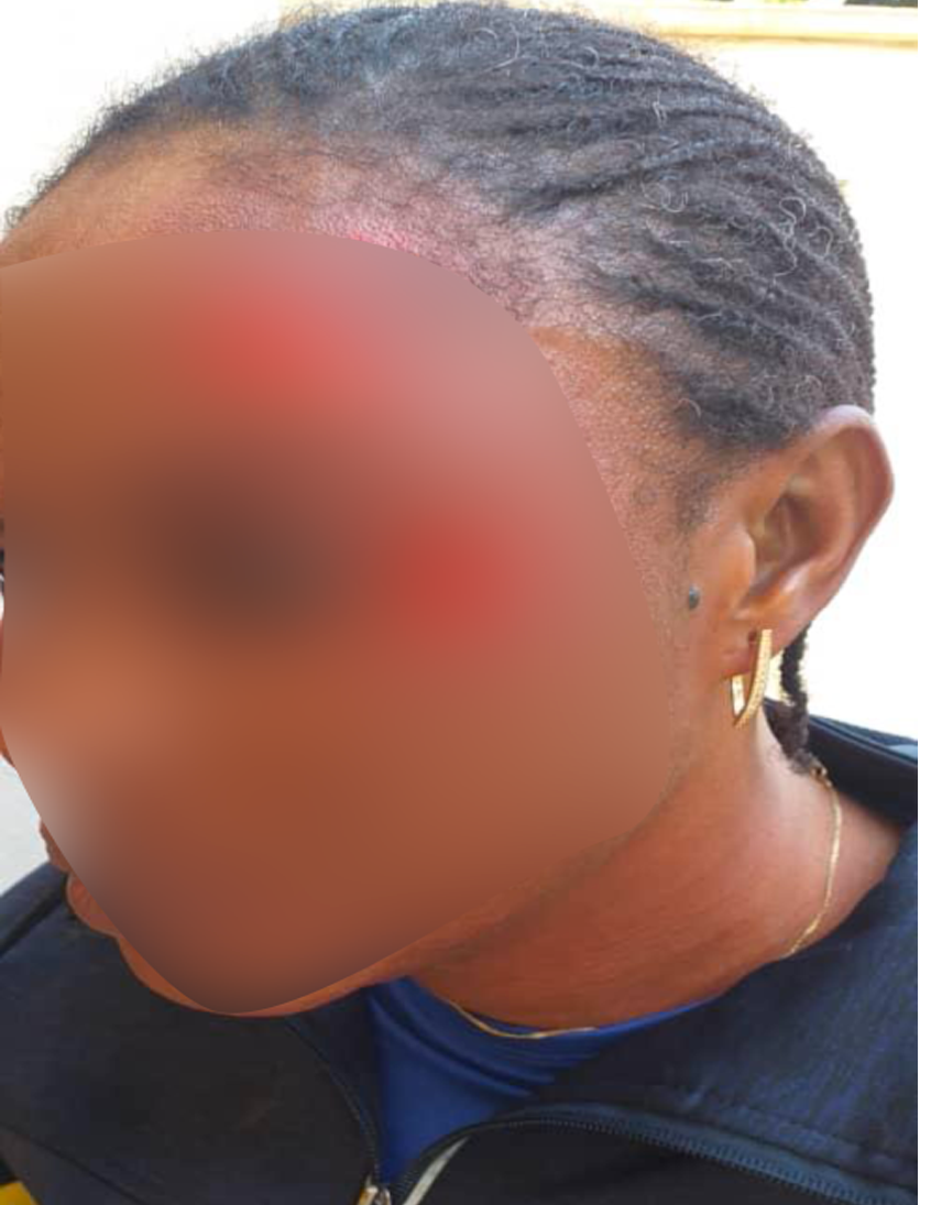 Lycée Blaise Diagne de Dakar: une élève agresse son professeur d’EPS et la défigure... les cours suspendus 