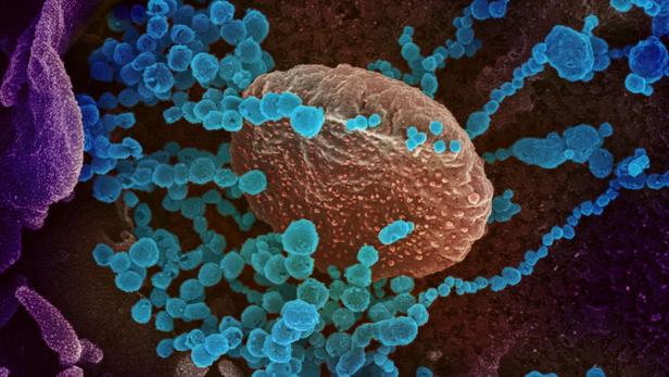 Coronavirus: bilan, symptômes, traitement... Toutes les réponses à vos questions sur l’épidémie de Covid-19