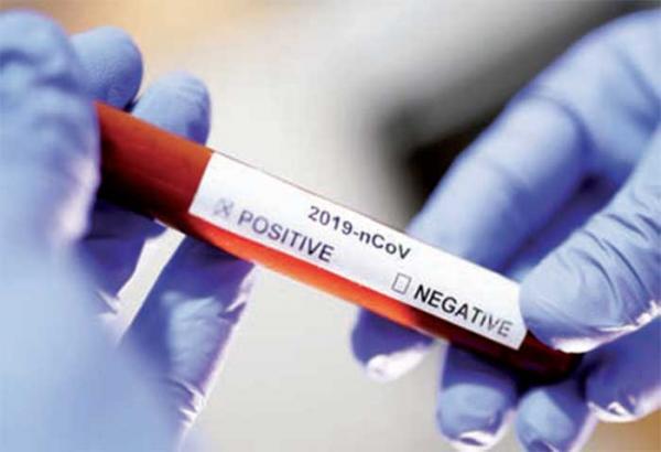 Tamba enregistre son premier cas de Covid19: le Sénégal encerclé par le virus