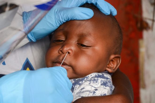 Un million de cas de coronavirus enregistrés en Afrique