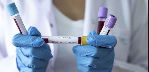 Covid-19 : le taux de létalité de la région de Diourbel dépasse le double du taux national