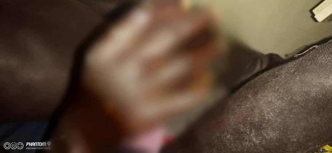 Panique à Thiaroye-sur-mer: une maladie mystérieuse fait des ravages épidermiques chez les pêcheurs