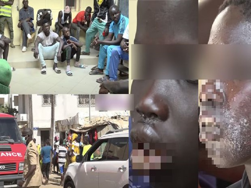 Maladie dermique à Thiaroye: Plus de 500 personnes infectées, seules les 18 sont hospitalisées