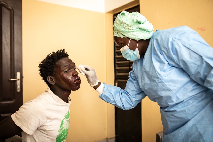 Dermatoses des pêcheurs: 507 cas répertoriés dans la région de Thiès