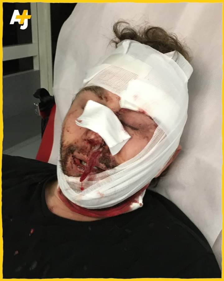 Marche des Libertés: les policiers français fracassent le visage d’un photojournaliste syrien