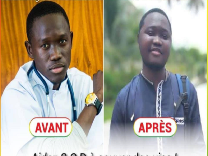 L'étudiant SOD évacué à Bordeaux, plus de 272 millions F Cfa mobilisés