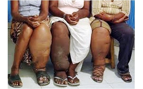 Maladies tropicales négligées: l'OMS publie un nouveau plan décennal