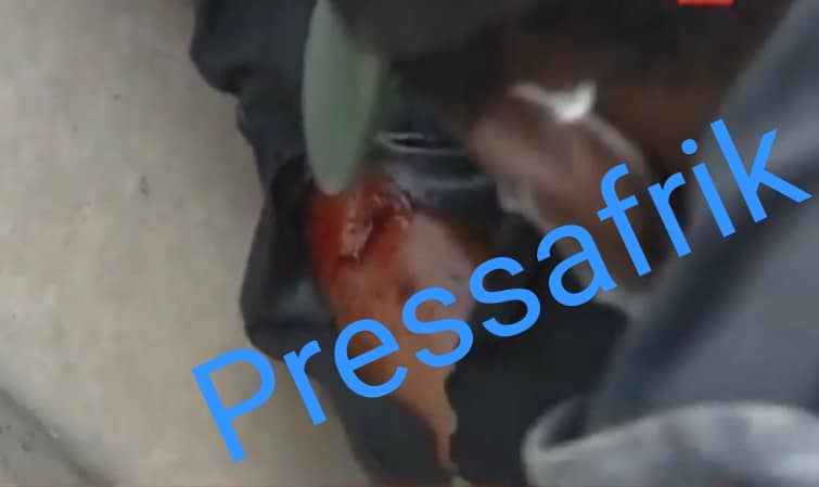 Affaire Ousmane Sonko : Un journaliste grièvement blessé (Images)