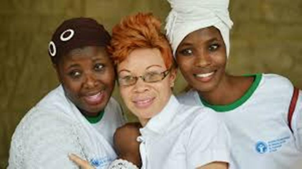 RDC: réunion sur les moyens de lutter contre les discriminations contre albinos