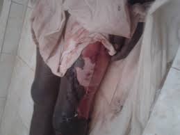 Mort Chérif Ndao: les images de l'horreur