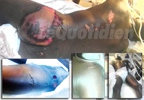 Mort Chérif Ndao: les images de l'horreur