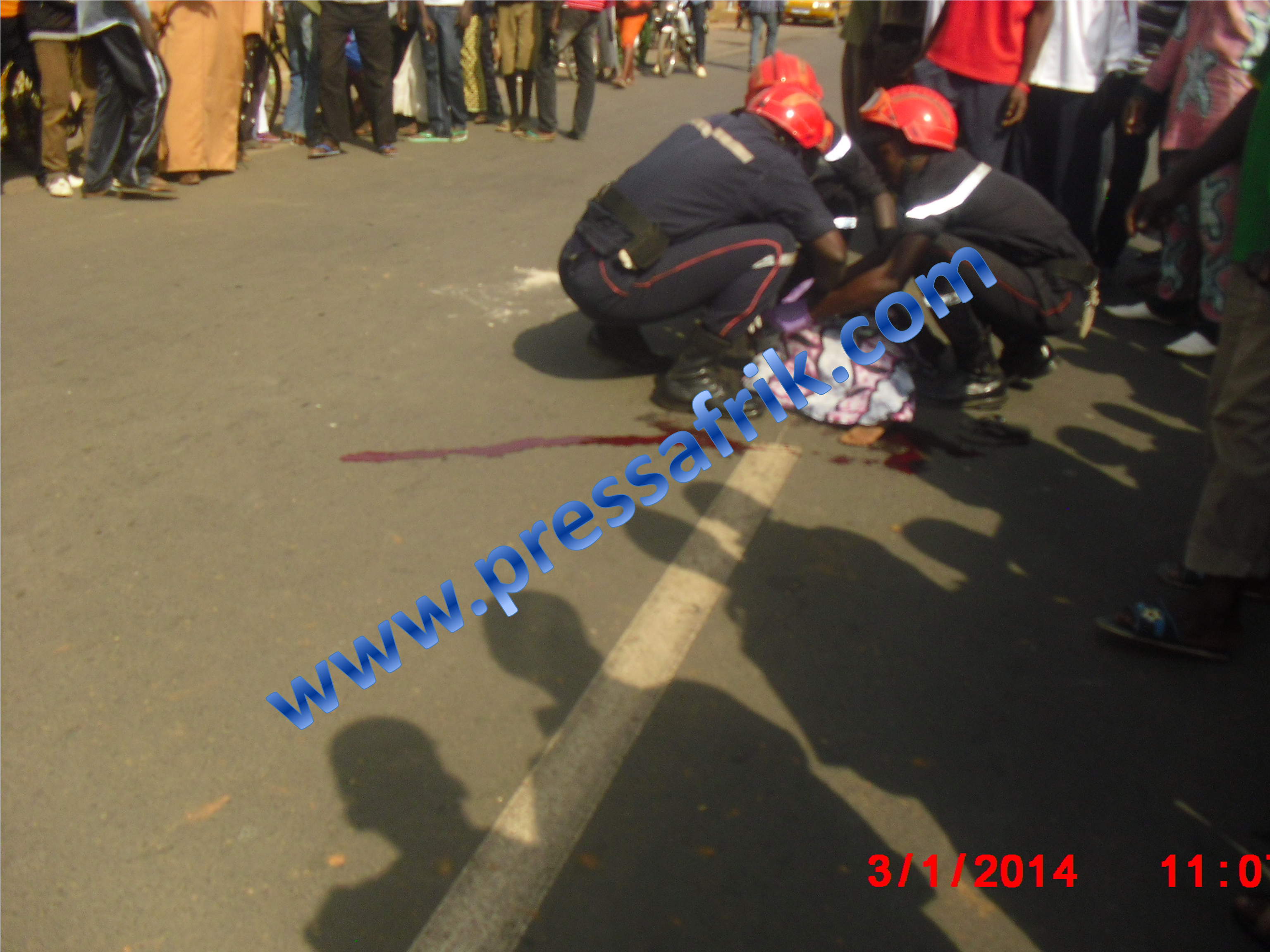 Ziguinchor : Un camion benne heurte violement un enfant de 07 ans