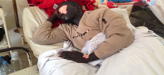 UCAD: les étudiants donnent 48 heures à l'Etat pour évacuer leur camarade "rendu borgne" au cours d'un front