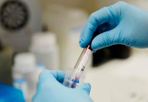 Médecine prédictive : serez-vous encore en vie dans cinq ans ?