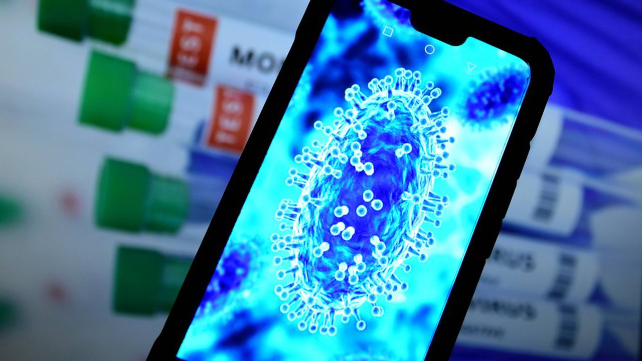 Espagne: deuxième décès d'un patient contaminé par la variole du singe