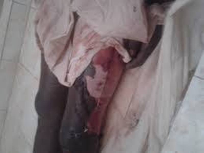 Mort Chérif Ndao-le sapeur pompier vengé ? Le Doyen des juges sert sept inculpations et vise deux médecins