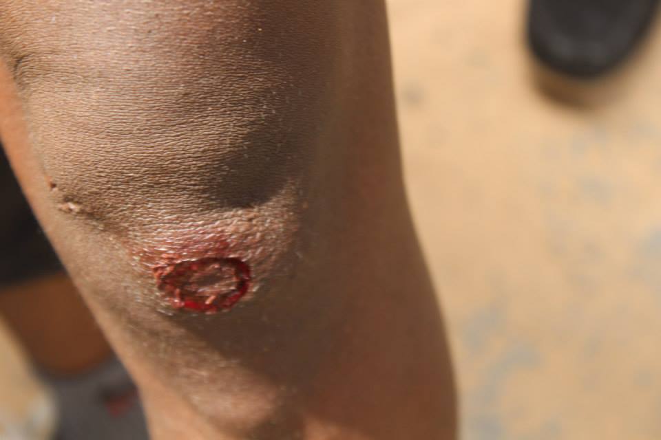 Les images de la barbarie policière à l'UCAD (âme sensible s'abstenir)