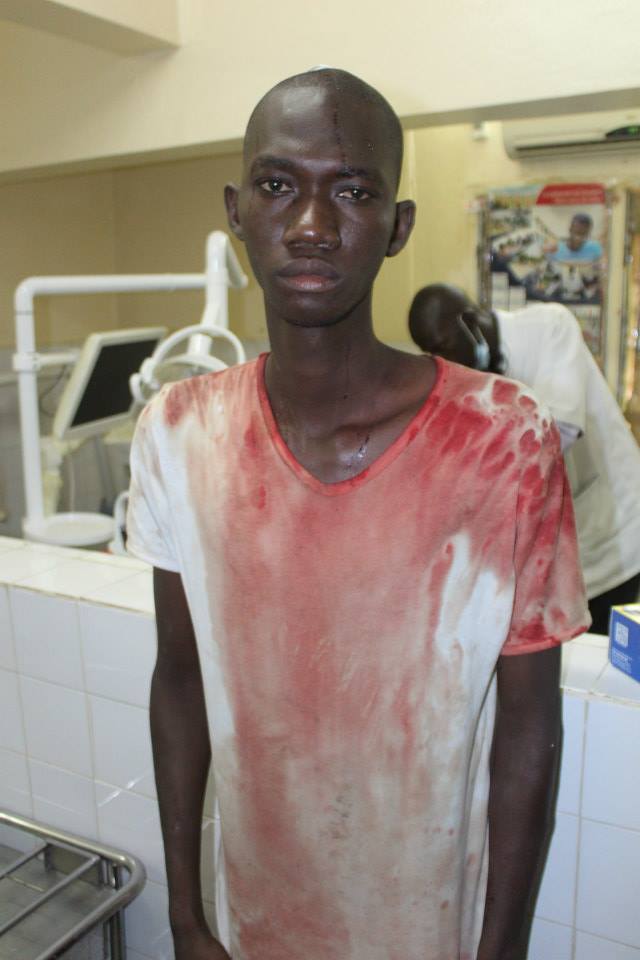 Les images de la barbarie policière à l'UCAD (âme sensible s'abstenir)