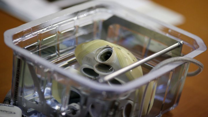 Santé: Un deuxième cœur artificiel implanté à Nantes