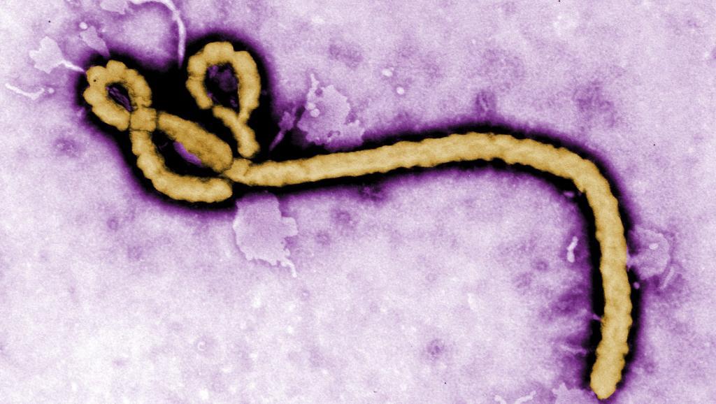 Particule virale d'Ebola observée au microscope électronique. REUTERS/Frederick Murphy