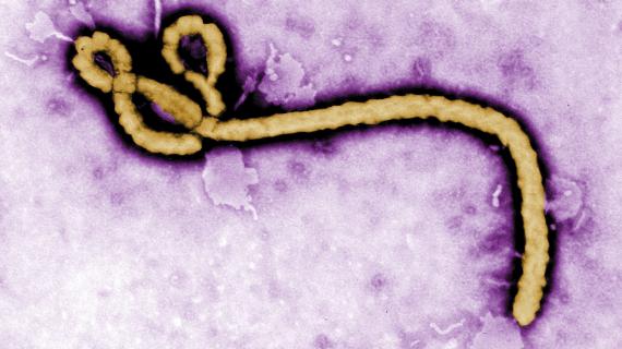 Ebola : le malade du Texas est dans un état très grave, indique l’hôpital où il est traité