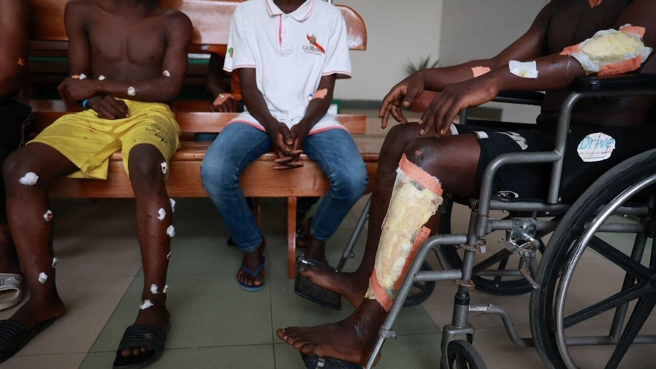 Cameroun: trois explosions font 18 blessés au départ de la course de l'Espoir
