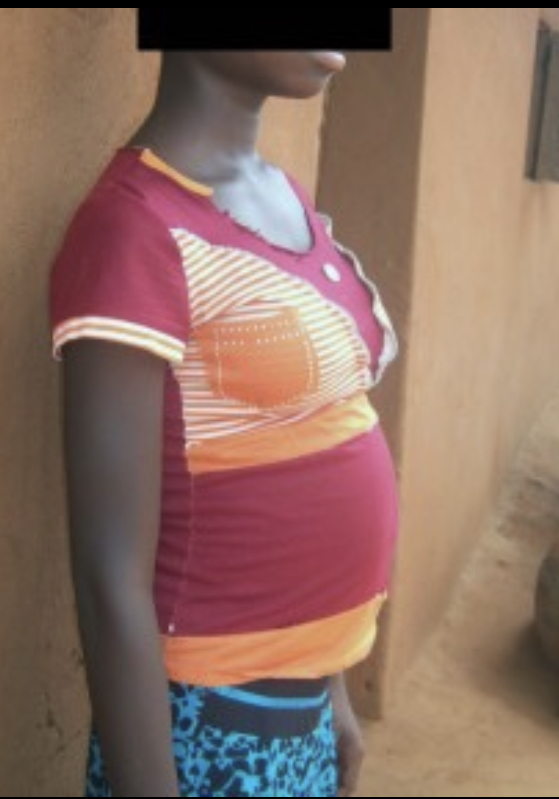 Linguére : une fillette de 16 ans accuse deux personnes de viol suivi de grossesse 
