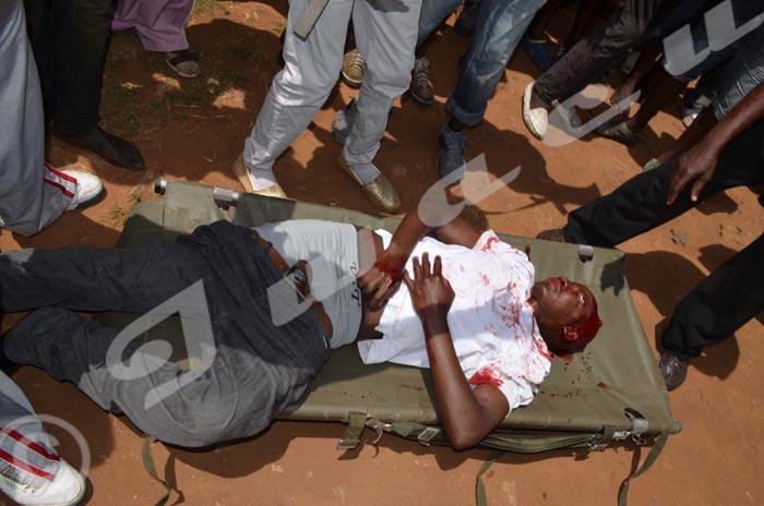 Burundi ça dégénère : La police tire à bout portant, des blessés très graves, un candidat porté disparu