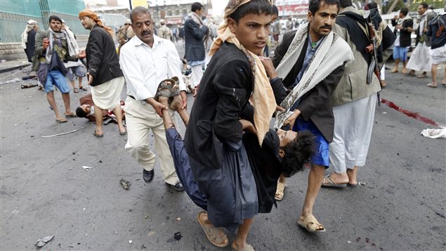Yemen: les combats se poursuivent, 10 morts 