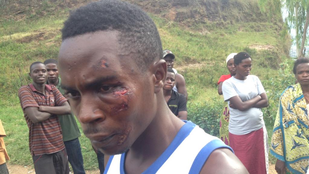 Un jeune militant FNL dit avoir été attaqué par un groupe d'Imbonerakure. «C'est parce que nous sommes contre le troisième mandat.» RFI / SR