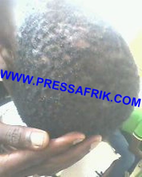 PHOTOS UCAD: cinq blessés gisent au service médical