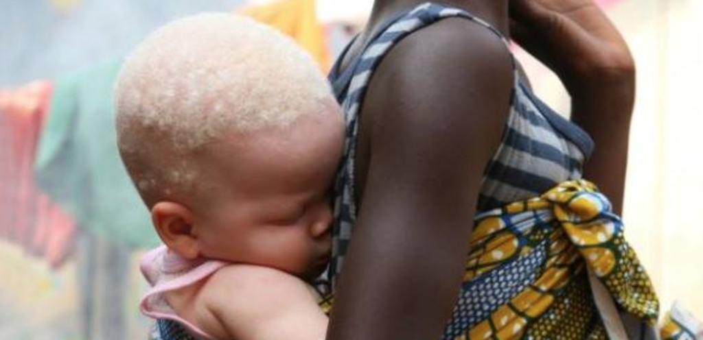 UN HOMME ARRÊTÉ POUR AVOIR TENTÉ DE VENDRE SA PETITE AMIE ALBINOS