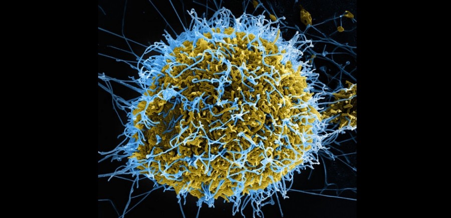 Attention : les « guéris » d’Ebola sont-ils réellement guéris ?