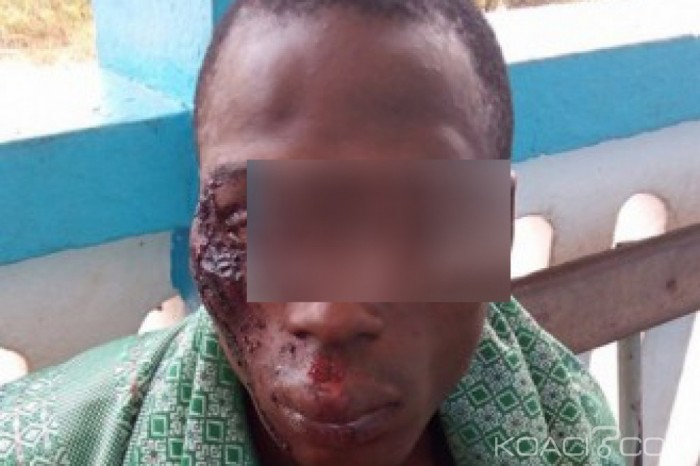 Côte d'Ivoire: Prétextant un couvre-feu, les Dozos chargent les villageois à l'ouest du pays, plusieurs blessés par balles