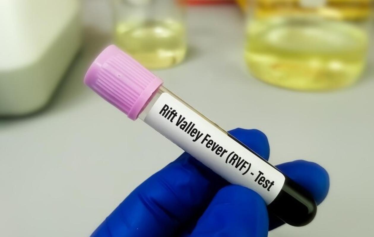 Fièvre de la Vallée du Rift : 21 cas confirmés dont 7 décès (Ministre)