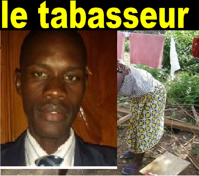 Le maire de Taïf dans de beaux draps: il bat sa femme et lui casse le bras