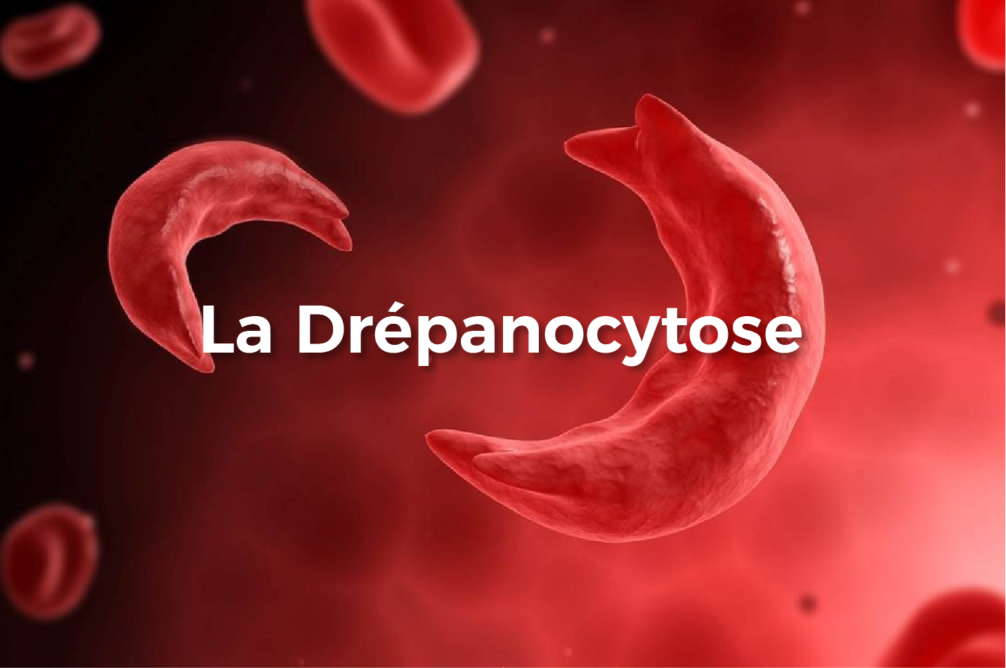 Drépanocytose à Kolda : plus de 250 enfants suivis et un traitement à vie inaccessible pour les familles