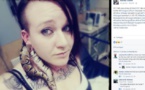 Etats-Unis : elle termine aux urgences à cause d'un serpent coincé dans son oreille