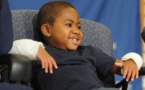 USA: première greffe des deux mains chez un enfant