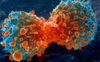 2000 nouveaux cas de cancer chaque année : la LISCA mise sur les consultations