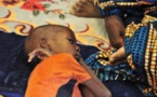 Mali : l'UNICEF tire la sonnette d'alarme sur la malnutrition