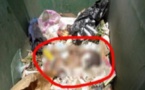 ​Jaxaay : Un nouveau-né retrouvé dans un seau hermétiquement fermé