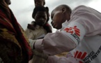 En RDC, la rougeole continue ses ravages