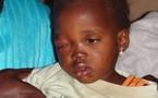 Thiès : Faute de moyens, Dieynaba Fall risque de perdre son œil