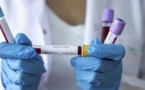 Coronavirus: le Sénégal va atteindre son pic de contamination dans 10 jours au maximum (Directrice Santé publique)