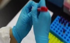Coronavirus Sénégal: on s’est trompé sur les tests des 10 médecins de l’ORL Fann déclarés positifs 