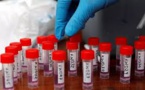 Afrique de l’Est: difficile coordination régionale dans la lutte contre le coronavirus