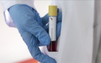 #Covid19Sn - Relâchement dans la lutte, dangereuse mutation du virus, négativité douteuse des tests... des médecins alertent